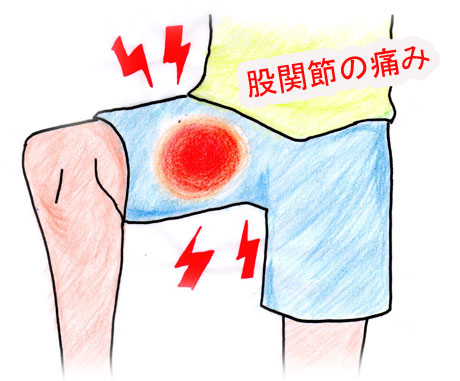 股関節痛 太ももの付け根の痛み 北九州小倉南の整体 医療関係者も通う北九州整体院