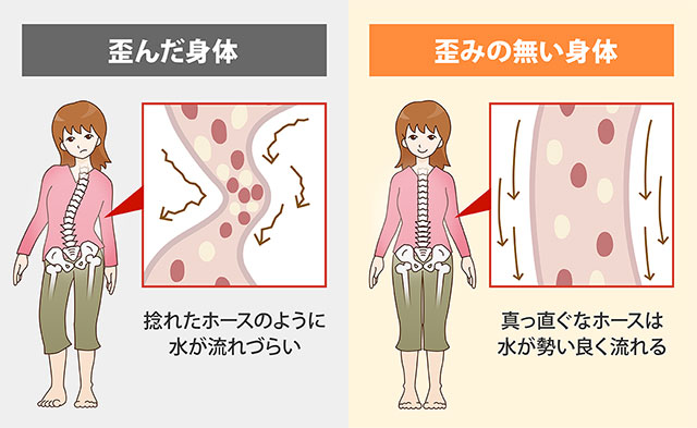 歪んだ身体＆歪みの無い身体
